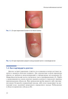 лечение заболеваний ногтей. краткое руководство по современным методам терапии (твердый переплет)