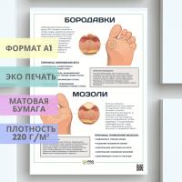 бородавки и мозоли (плакат)