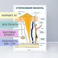 Стержневая мозоль (плакат)