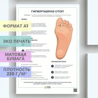 гипергидроз стоп