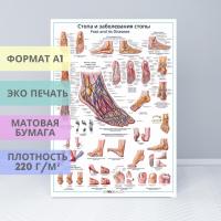 Стопа и заболевания стопы (плакат)