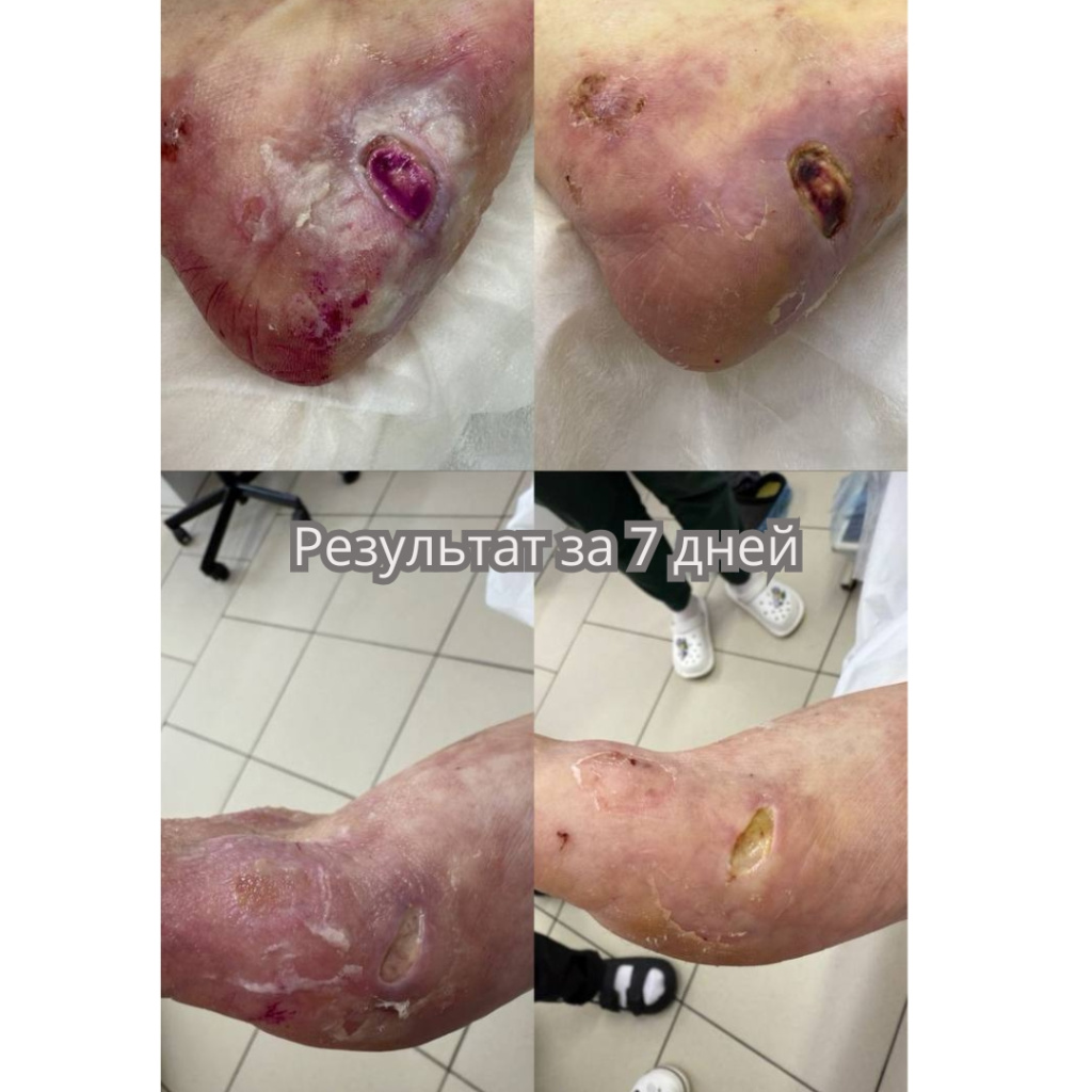 подология (3).jpg