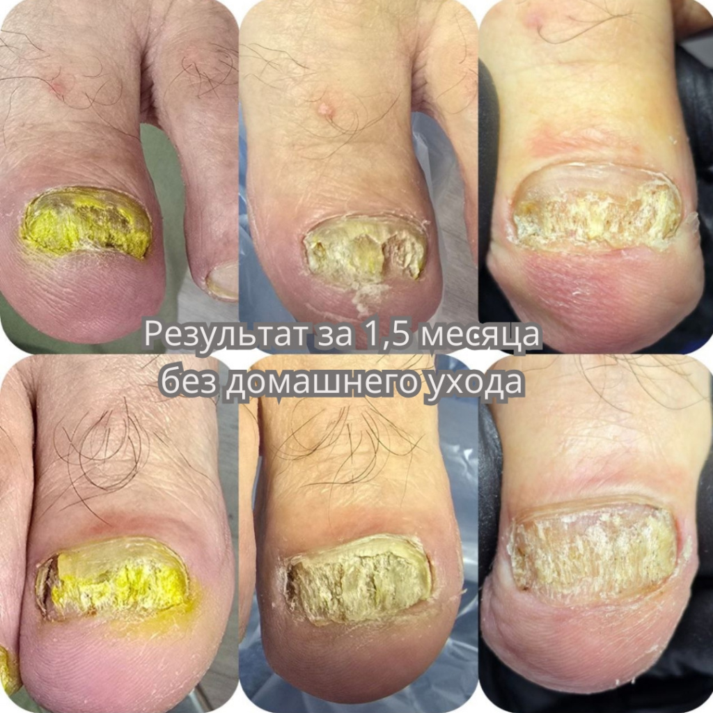 подология (1).jpg