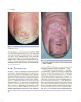 дифференциальная диагностика поражений ногтей. атлас