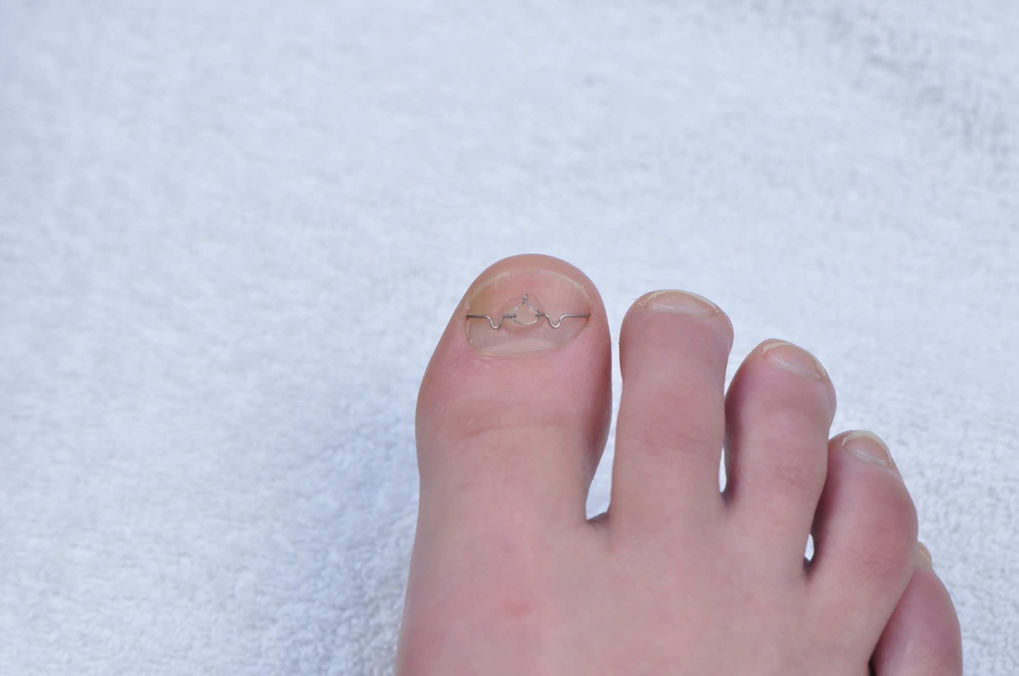 набор петель 3to (10 шт)