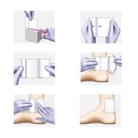 omnifix elastic (омнификс эластик), нетканый фиксирующий пластырь для сплошного покрытия