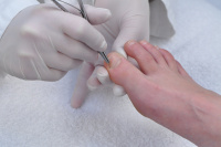 щипцы-зажим (иглодержатель) masako