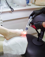 Аппарат АФС-Подолог (АФСк-660) для противогрибковой обработки ногтей фото аппарат афс-подолог (афск-660) для противогрибковой обработки ногтей