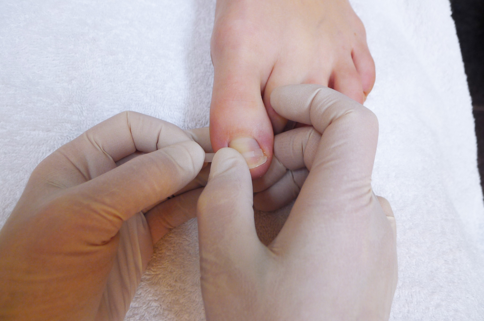 стартовый набор podostripe