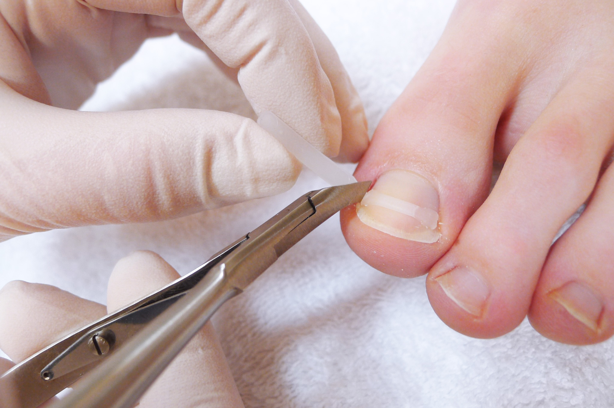 стартовый набор podostripe