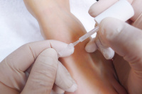 Клей для ортониксии Ortho Glue (7 мл)