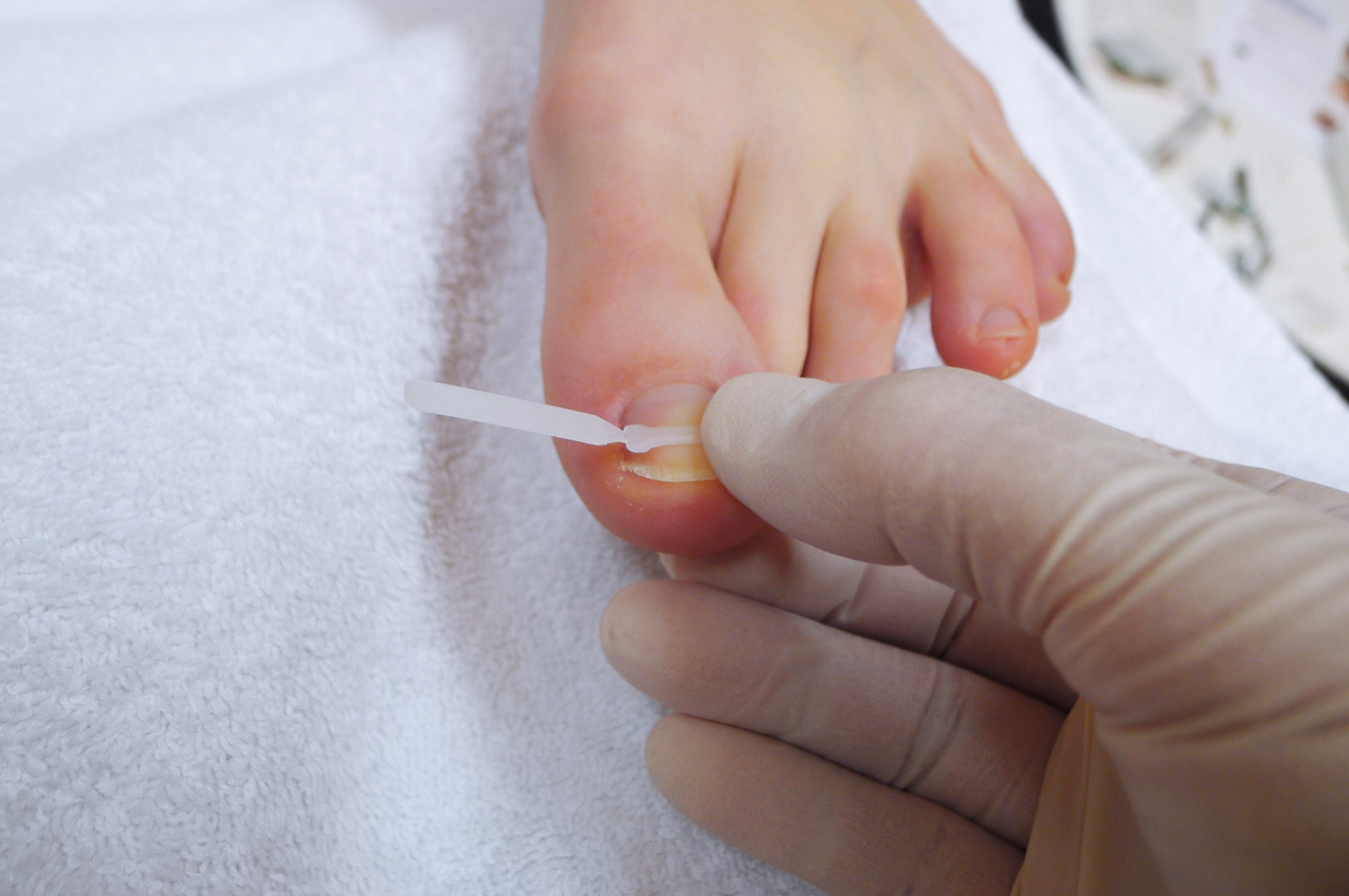 стартовый набор podostripe