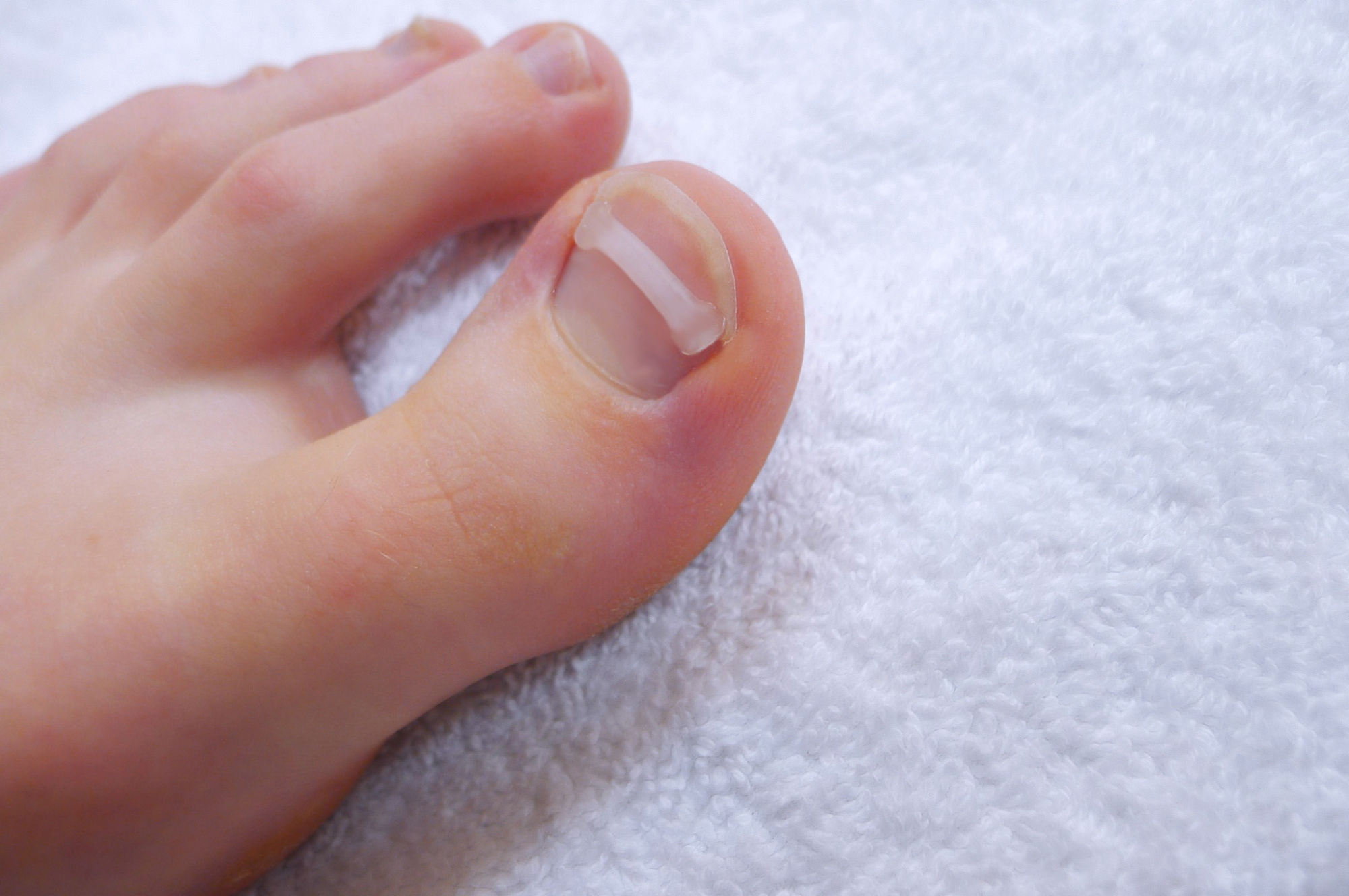 стартовый набор podostripe